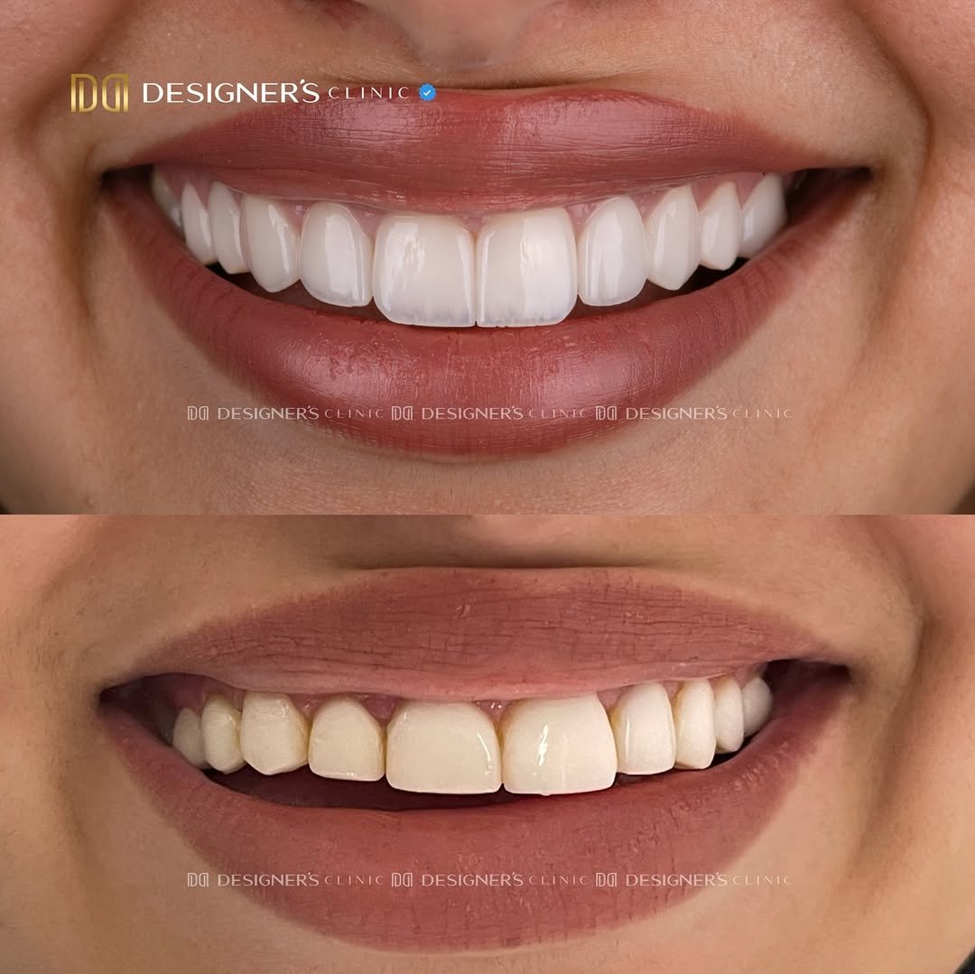 افضل طبيبة تجميل اسنان بالرياض افضل طبيبة تجميل اسنان بالرياض