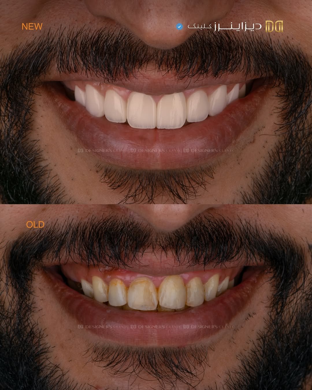 افضل طبيبة تجميل اسنان بالرياض افضل طبيبة تجميل اسنان بالرياض