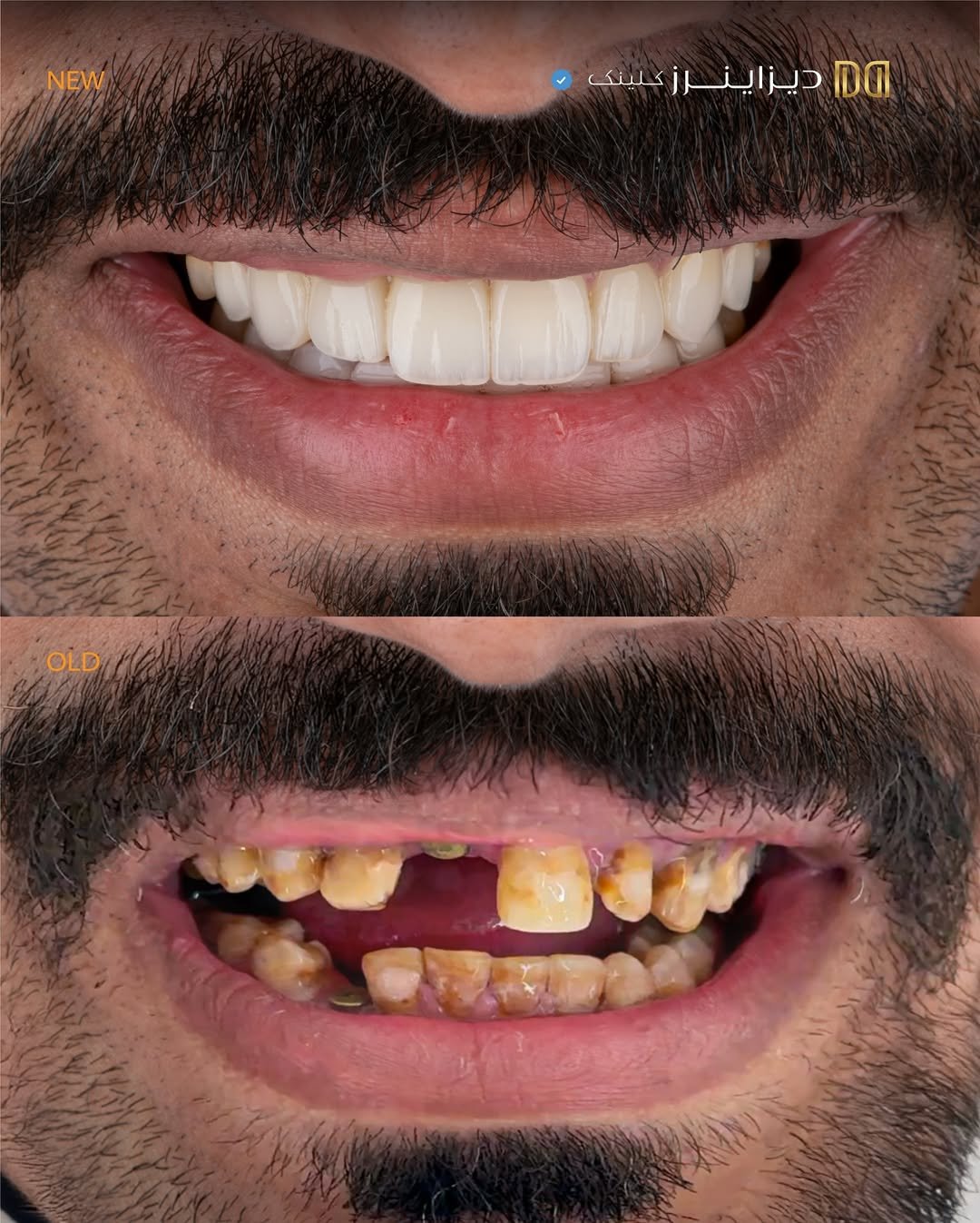 افضل طبيبة تجميل اسنان بالرياض افضل طبيبة تجميل اسنان بالرياض