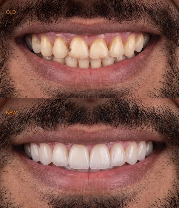 افضل طبيبة تجميل اسنان بالرياض