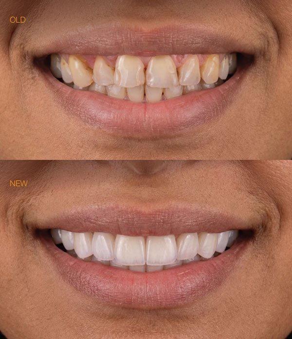 افضل طبيبة تجميل اسنان بالرياض