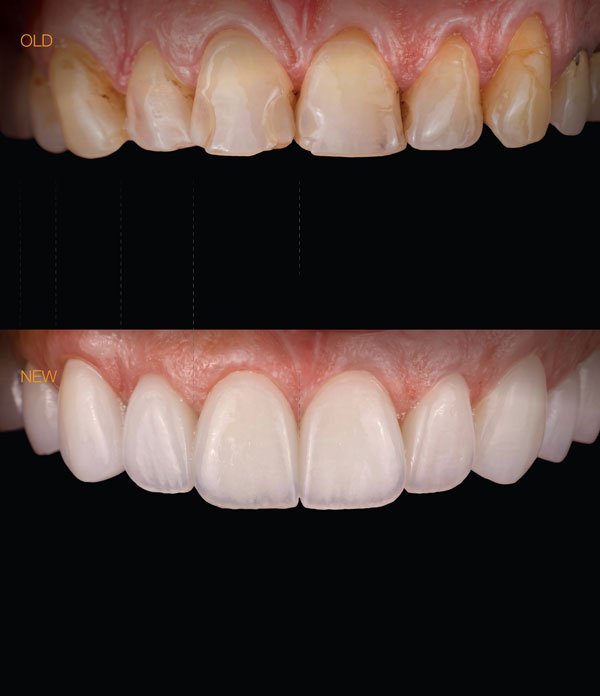 افضل طبيب تجميل اسنان بالرياض